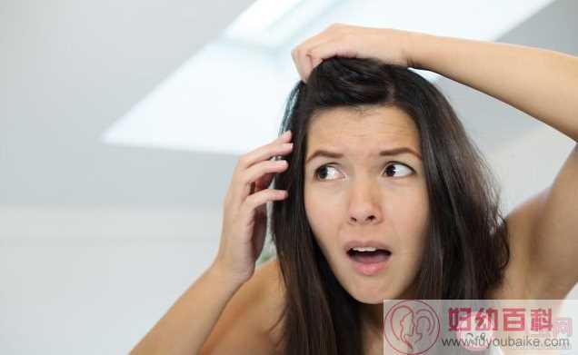 头皮出油太多会导致脱发吗 怎么改善头发出油