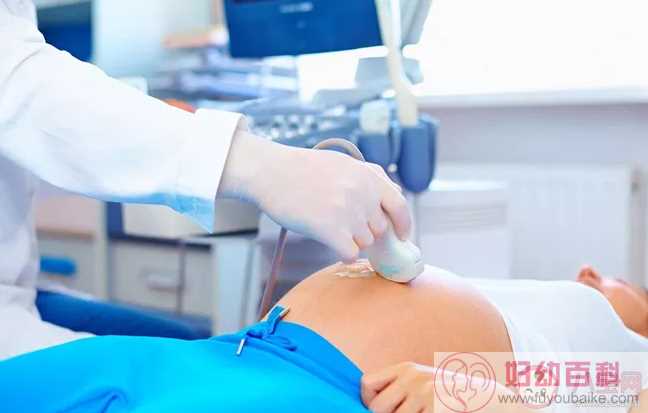 怀孕早期应该做阴超还是腹超 孕早期做阴道B超会不会影响胎儿