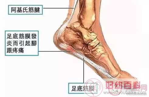 脚后跟疼是什么原因导致的 脚后跟疼怎么治疗