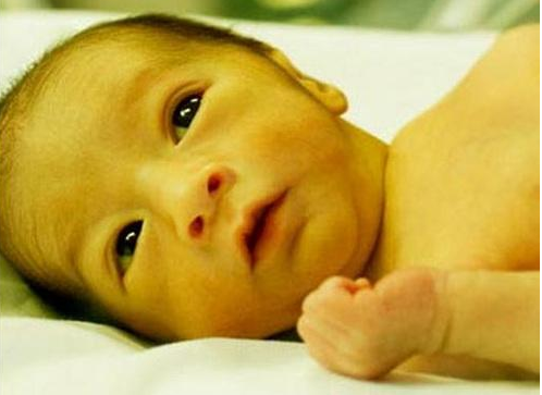 宝宝喂黄连水可以去胎毒吗 什么样的孕妈体质更容易生出胎毒宝宝