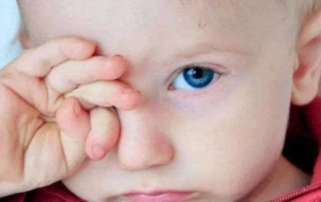 宝宝眼睛分泌物增多是怎么回事 怎么通过宝宝眼睛分泌物判断健康