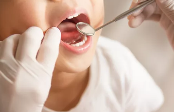 孩子乳牙反颌几岁矫正最好 孩子乳牙反颌矫正时间