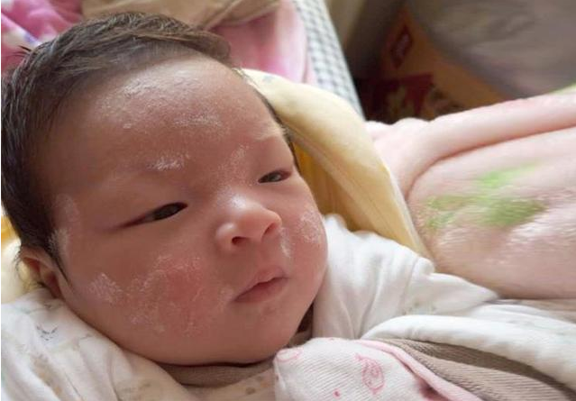 母乳能给宝宝擦脸吗 春季宝宝皮肤护理小方法