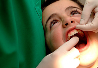预防宝宝牙齿长歪的方法 换牙期怎么矫正牙齿