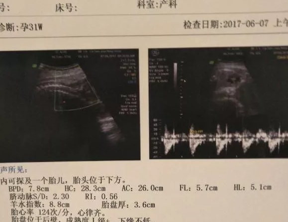 2019年4月13日怀孕生男生女 农历三月初九怀孕是男孩还是女孩