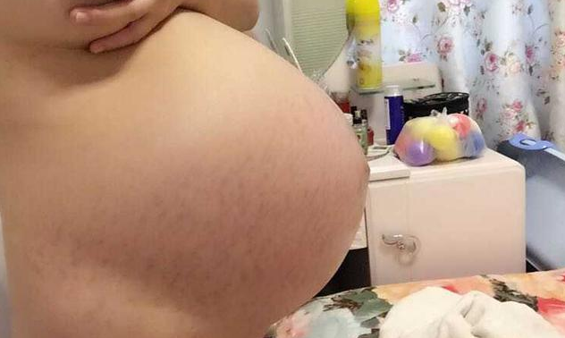 怎么看孕妇肚子尖还是圆 孕妇尖肚子和圆肚子对照图：