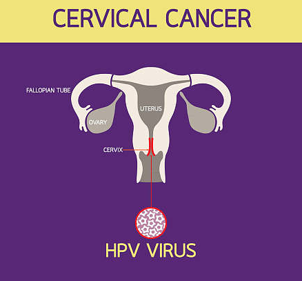 HPV疫苗会导致不孕吗 HPV疫苗会导致卵巢功能不全吗