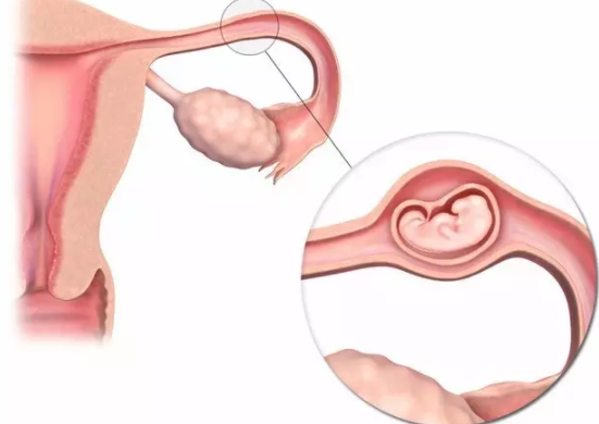 子宫内膜太薄怎么办 子宫内膜太薄调理方法