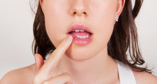 坐月子口腔溃疡怎么办 产后口腔溃疡治疗方法